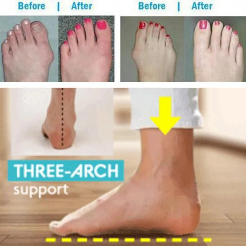 Slippers Women Fashion Flats Wedges Open Toe Ankle Beach Shoes Woman Roman Slippers Sandalias Home Shoes Kapcie Zapatos De Mujer